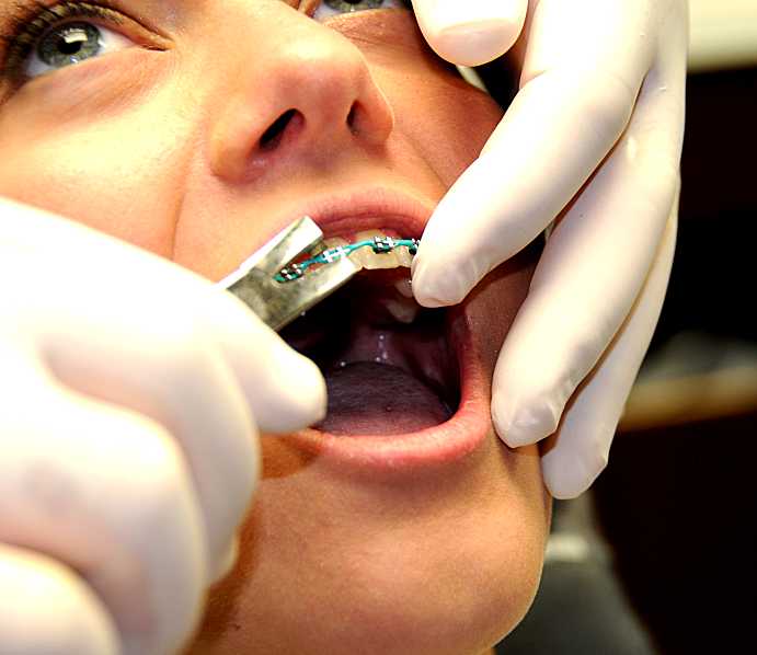 change orthodontists