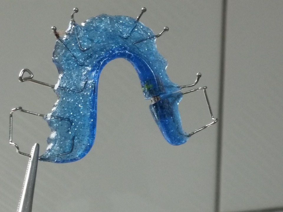 How Is Invisalign Different from Traditional Braces?