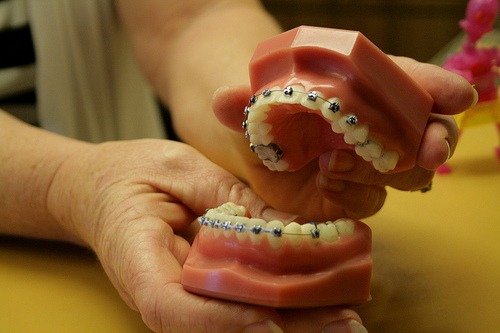 Three Reasons Your Orthodontic Braces Are Still On