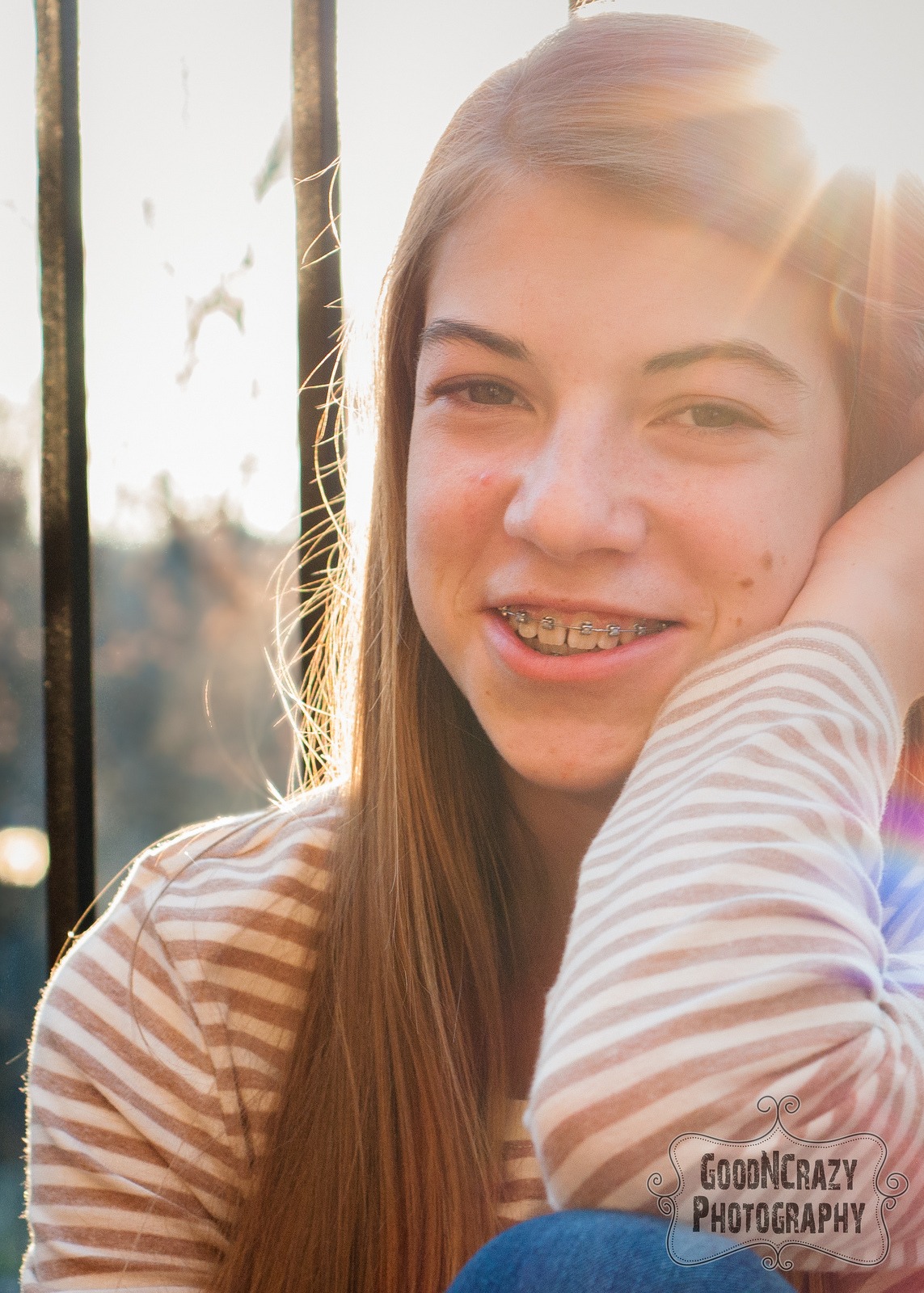 Five Tips in Caring for Your Braces during Orthodontic Treatment