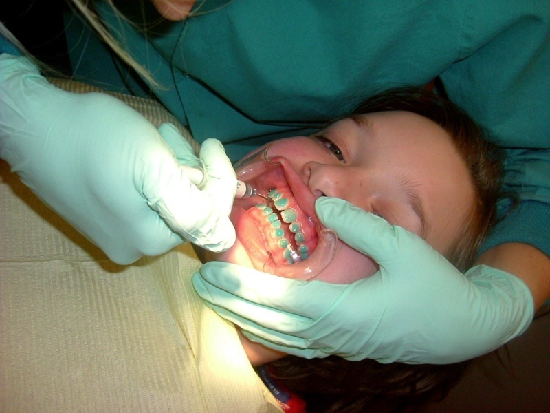 Why is a Dentist Not an Orthodontist?