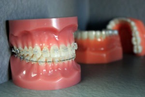 tooth model