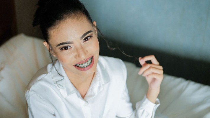 What You Need to Know About Clear Ceramic Braces